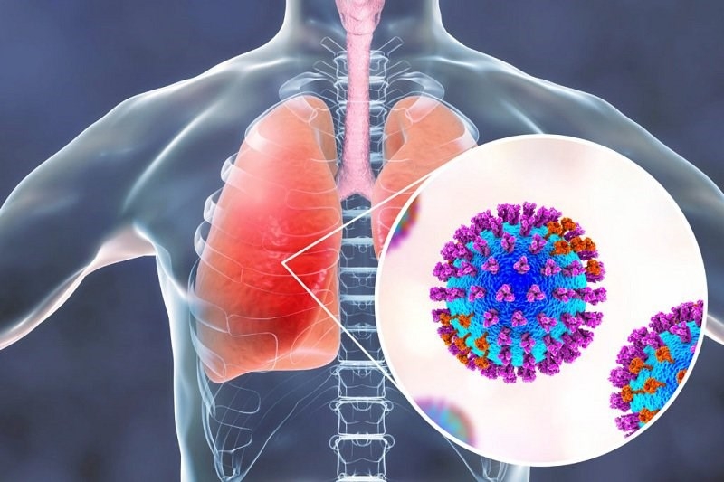 Virus đường hô hấp tiếp tục lan rộng khắp Hoa Kỳ